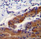 DFNB31 Antibody immunohistochemistry of formalin-fixed and paraffin-embedded stomach tissue followed by peroxidase-conjugated secondary antibody and DAB staining.