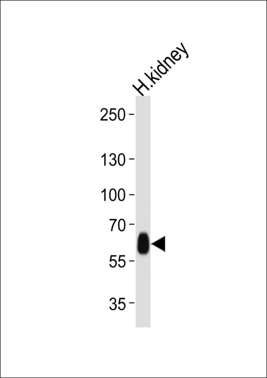 Western blot of lysate from human kidney tissue lysate, using DFNB31 Antibody. Antibody was diluted at 1:1000 at each lane. A goat anti-rabbit IgG H&L (HRP) at 1:5000 dilution was used as the secondary antibody. Lysate at 35ug per lane.