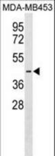PJVK Antibody western blot of MDA-MB453 cell line lysates (35 ug/lane). The PJVK antibody detected the PJVK protein (arrow).