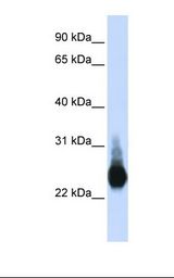 Transfected 293T cell lysate. Antibody concentration: 1.0 ug/ml. Gel concentration: 12%.
