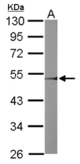 Sample (50 ug of whole cell lysate). A: mouse liver. 10% SDS PAGE. DGAT2 antibody diluted at 1:1000.