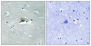 IHC of paraffin-embedded human brain, using Claudin 5 (Phospho-Tyr217) Antibody. The sample on the right was incubated with synthetic peptide.