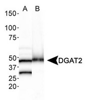 Western Blot: DGAT2 Antibody - Analysis of DGAT2 in A. human liver lysate and B. mouse brain lysate.