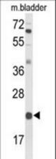 Western blot of DGCR6 Antibody in mouse bladder tissue lysates (35 ug/lane). DGCR6 (arrow) was detected using the purified antibody.