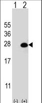 Western blot of DGCR6L (arrow) using rabbit polyclonal DGCR6L Antibody. 293 cell lysates (2 ug/lane) either nontransfected (Lane 1) or transiently transfected (Lane 2) with the DGCR6L gene.