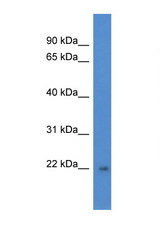 DGCR6L antibody LS-C135899 Western blot of Fetal Brain lysate. Antibody concentration 1 ug/ml.