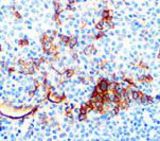 IHC of Cytokeratin Claudin-5 on FFPE Liver tissue.
