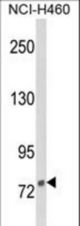 Western blot of DGCR8 Antibody in NCI-H460 cell line lysates (35 ug/lane). DGCR8 (arrow) was detected using the purified antibody.