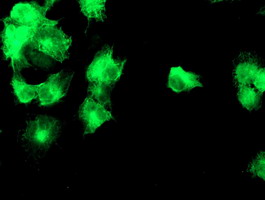 Anti-DGKA mouse monoclonal antibody immunofluorescent staining of COS7 cells transiently transfected by pCMV6-ENTRY DGKA.