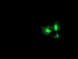 Anti-DGKA mouse monoclonal antibody immunofluorescent staining of COS7 cells transiently transfected by pCMV6-ENTRY DGKA.