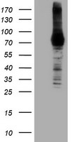 HEK293T cells were transfected with the pCMV6-ENTRY control (Left lane) or pCMV6-ENTRY DGKA (Right lane) cDNA for 48 hrs and lysed. Equivalent amounts of cell lysates (5 ug per lane) were separated by SDS-PAGE and immunoblotted with anti-DGKA.