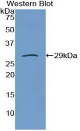 Western blot of recombinant DGKA.