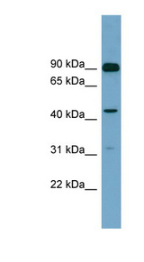 DGKA antibody LS-C111519 Western blot of Fetal Heart lysate.
