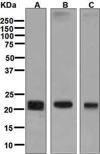 Western blot analysis on (A) fetal brain, (B) human lung squamous cell cancer, and (C) human small cell lung cancer lysates using anti-CLDN5 / Claudin 5 antibody.