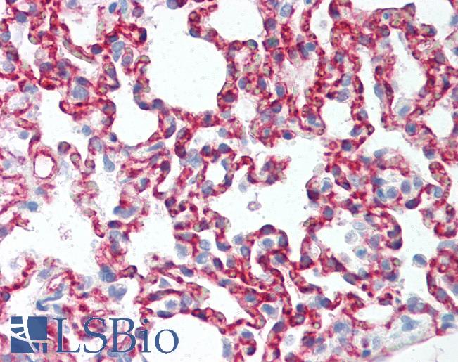 Anti-CLDN5 / Claudin 5 antibody IHC of rat lung. Immunohistochemistry of formalin-fixed, paraffin-embedded tissue after heat-induced antigen retrieval. Antibody LS-B2331 concentration 10 ug/ml.