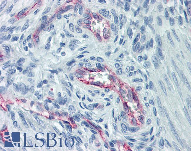 Anti-CLDN5 / Claudin 5 antibody IHC of human uterus, vessels. Immunohistochemistry of formalin-fixed, paraffin-embedded tissue after heat-induced antigen retrieval. Antibody LS-B5971 concentration 5 ug/ml.