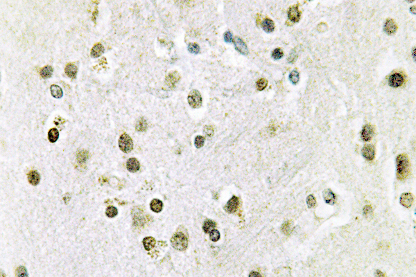 IHC of DGK- (S725) pAb in paraffin-embedded human brain tissue.