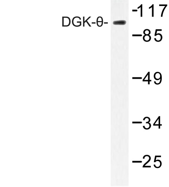 Western blot of DGK- (S725) pAb in extracts from HT-29 cells.