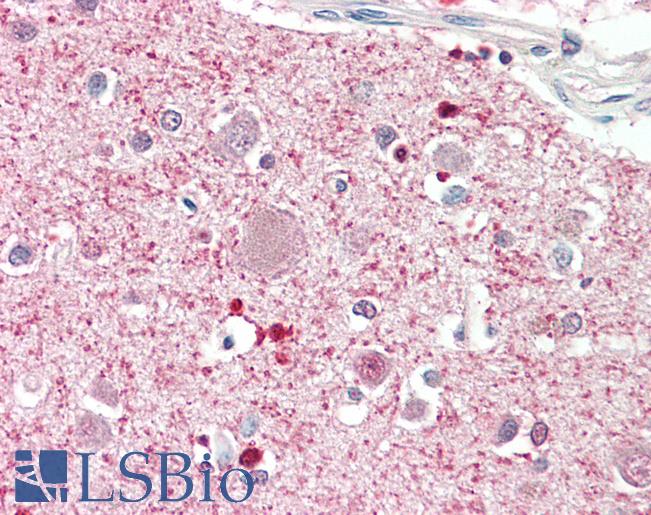 Anti-DGKQ antibody IHC staining of human brain, cortex. Immunohistochemistry of formalin-fixed, paraffin-embedded tissue after heat-induced antigen retrieval. Antibody LS-B10348 concentration 5 ug/ml.