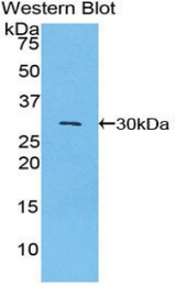 Western blot of recombinant DGKZ.