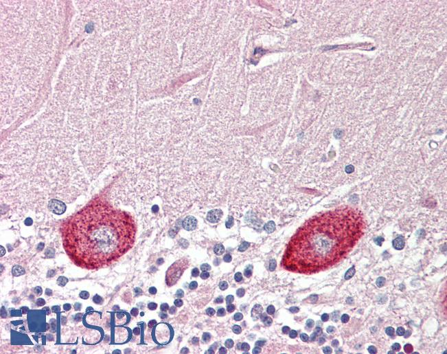 Anti-DGKZ antibody IHC of human brain, cerebellum. Immunohistochemistry of formalin-fixed, paraffin-embedded tissue after heat-induced antigen retrieval. Antibody LS-B8416 dilution 5 ug/ml.
