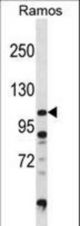 DGKZ Antibody (D1004) western blot of Ramos cell line lysates (35 ug/lane). The DGKZ antibody detected the DGKZ protein (arrow).