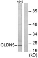 Western blot of extracts from A549 cells, using Claudin 5 Antibody. The lane on the right is treated with the synthesized peptide.