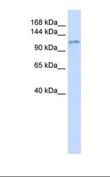 Fetal heart lysate. Antibody concentration: 1.0 ug/ml. Gel concentration: 6-18%.
