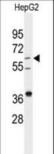 Western blot of anti-DHCR24 Antibody in HepG2 cell line lysates (35 ug/lane). DHCR24 (arrow) was detected using the purified antibody.