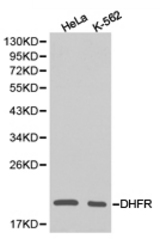 Western blot of extracts of various cell lines, using DHFR antibody.