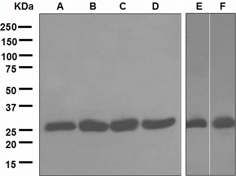 Western blot analysis on (A) HeLa, (B) Jurkat, (C) Y79, (D) 293T, (E) Mouse spleen and (F) Rat kidney lysates using anti-DHFR antibody.