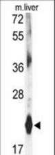Western blot of DHFR antibody in mouse liver tissue lysates (35 ug/lane). KLF4 (arrow) was detected using the purified antibody.