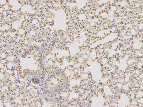 Immunohistochemistry of paraffin-embedded mouse lung using DHFR antibody at dilution of 1:100 (200x lens).