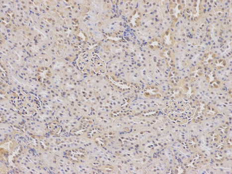 Immunohistochemistry of paraffin-embedded rat kidney using DHFR antibody at dilution of 1:100 (200x lens).