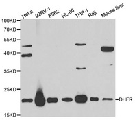 Western blot analysis of extracts of various cell lines, using DHFR antibody.