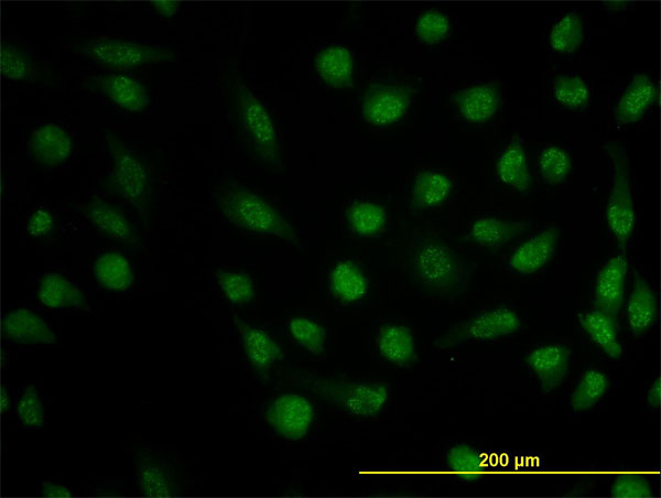 Immunofluorescence of monoclonal antibody to DHFR on HeLa cell. [antibody concentration 10 ug/ml]
