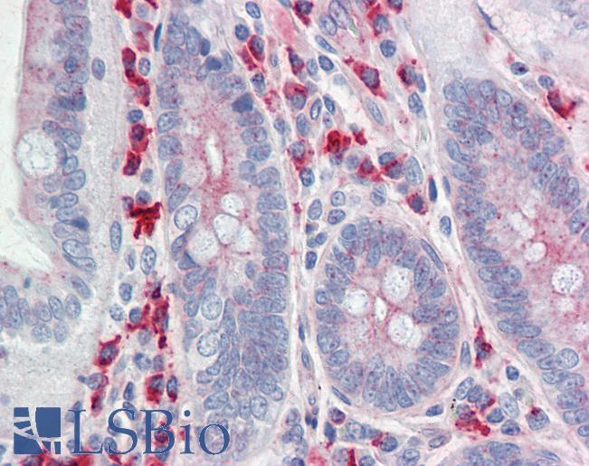 Anti-CLDN6 / Claudin 6 antibody IHC staining of human small intestine. Immunohistochemistry of formalin-fixed, paraffin-embedded tissue after heat-induced antigen retrieval.