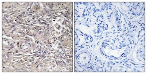 IHC of paraffin-embedded human ovary tissue, using CLDN6 Antibody. The picture on the right is treated with the synthesized peptide.