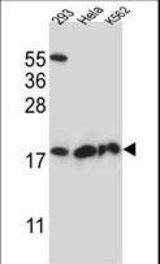 DHFRL1 Antibody western blot of 293,HeLa,K562 cell line lysates (35 ug/lane). The DHFRL1 antibody detected the DHFRL1 protein (arrow).