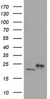 HEK293T cells were transfected with the pCMV6-ENTRY control (Left lane) or pCMV6-ENTRY DHFRL1 (Right lane) cDNA for 48 hrs and lysed. Equivalent amounts of cell lysates (5 ug per lane) were separated by SDS-PAGE and immunoblotted with anti-DHFRL1.