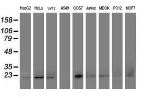 Western blot of extracts (35ug) from 9 different cell lines by using anti-DHFRL1 monoclonal antibody.