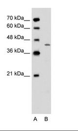 A: Marker, B: Jurkat Cell Lysate