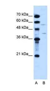DHODH antibody LS-C40354 Western blot of HepG2 cell lysate.