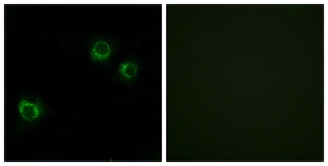 Immunofluorescence of HUVEC cells, using CLDN6 Antibody. The picture on the right is treated with the synthesized peptide.