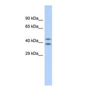 Western blot of Human HepG2. DHODH antibody dilution 1.0 ug/ml.