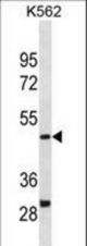 DHODH Antibody western blot of K562 cell line lysates (35 ug/lane). The DHODH antibody detected the DHODH protein (arrow).