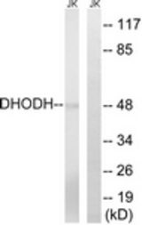 Western blot of extracts from Jurkat cells, using DHODH Antibody. The lane on the right was incubated with synthetic peptide.