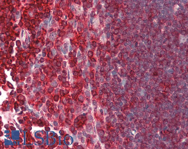 Human Thymus: Formalin-Fixed, Paraffin-Embedded (FFPE)