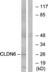 Western blot of extracts from Jurkat cells, using CLDN6 Antibody. The lane on the right is treated with the synthesized peptide.