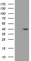 HEK293T cells were transfected with the pCMV6-ENTRY control (Left lane) or pCMV6-ENTRY DHPS (Right lane) cDNA for 48 hrs and lysed. Equivalent amounts of cell lysates (5 ug per lane) were separated by SDS-PAGE and immunoblotted with anti-DHPS.